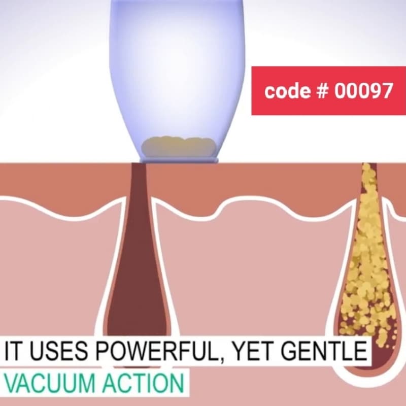 Durma Suction Black Heads Removing Machine Cell Operating