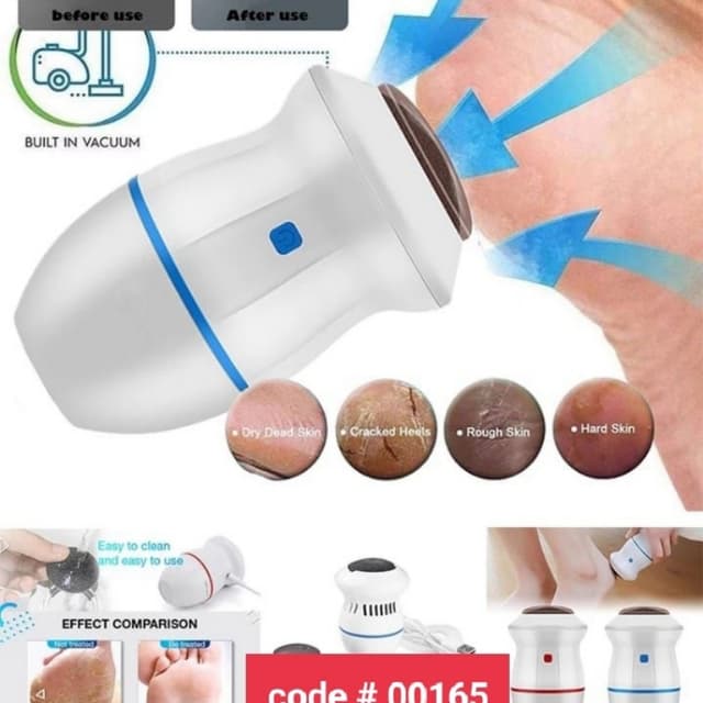 Electric Pedicure Tool Callus Remover With Builtin Vaccum
