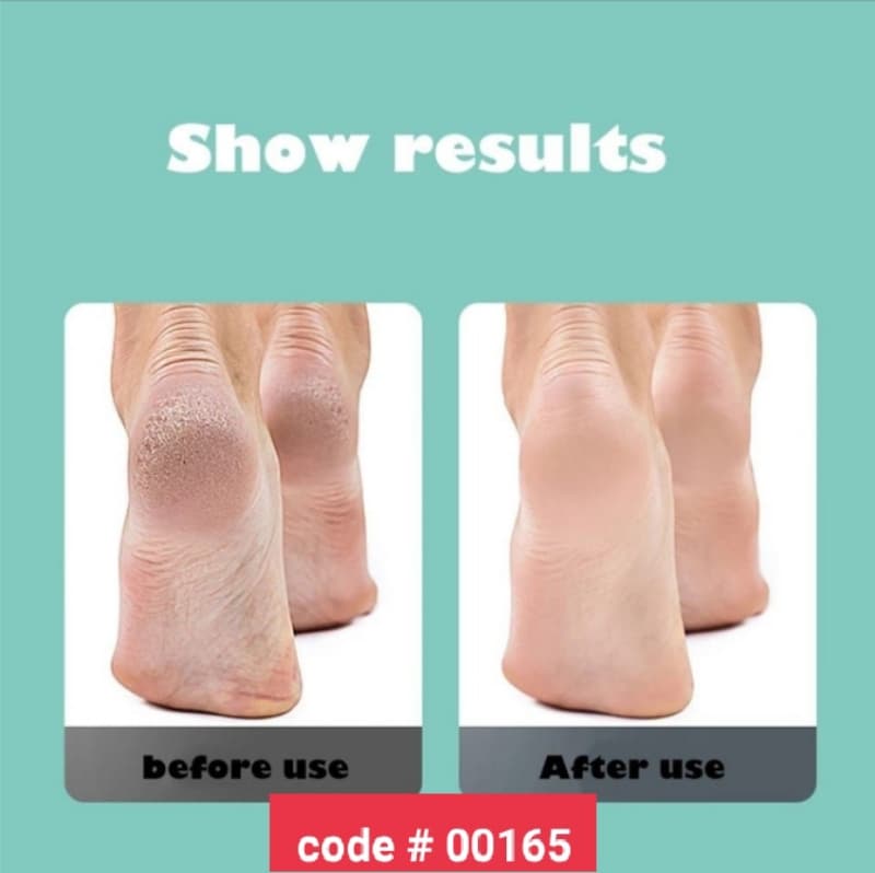 Electric Pedicure Tool Callus Remover With Builtin Vaccum
